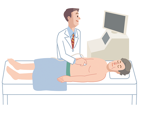 胆道がんの腹部超音波検査のイラスト