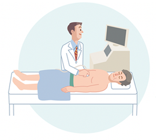 腹部超音波検査のイラスト