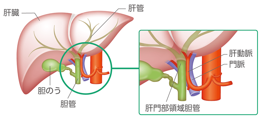 肝門部領域胆管がんの部位のイメージ​