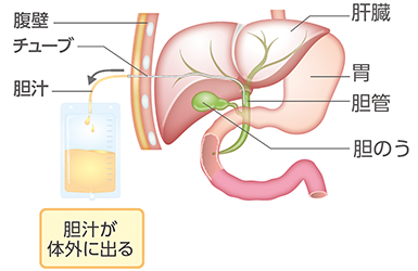 肝臓を通ってお腹から体の外へ胆汁を出す場合の体内の様子のイラスト