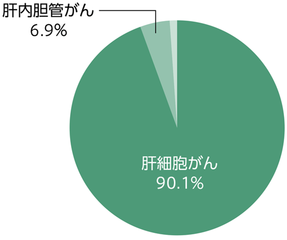 原発性肝がんの内訳を示すグラフ。日本では90％以上を「肝細胞がん」が占めます。