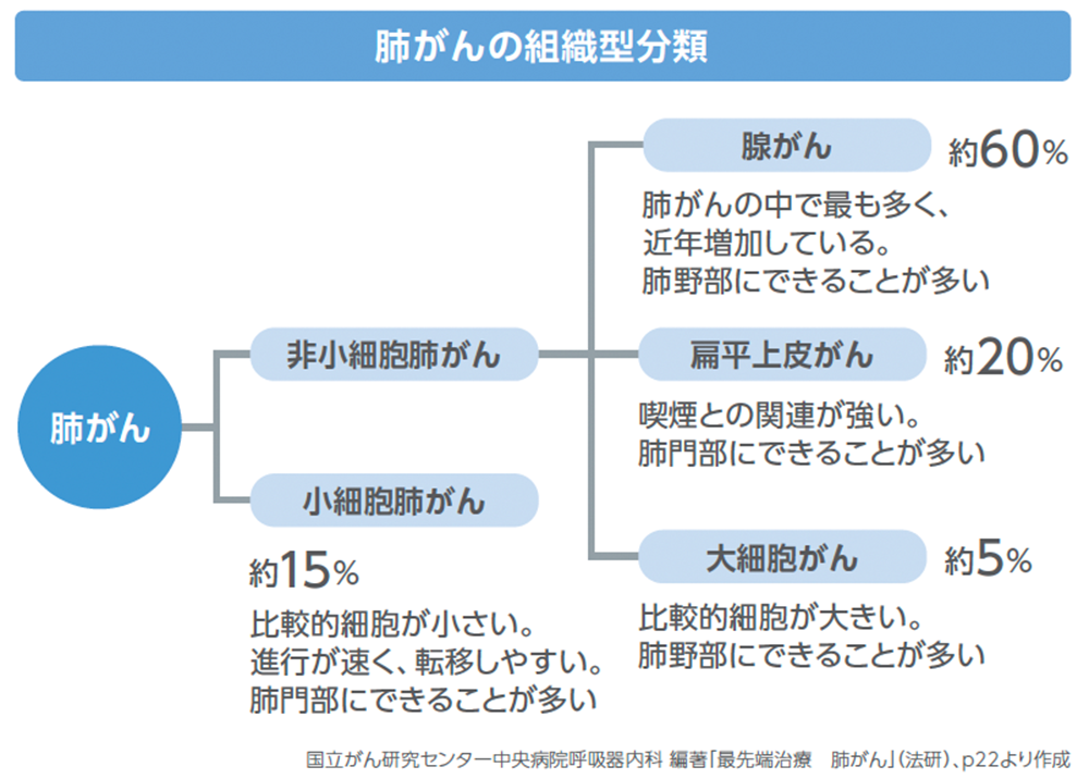 肺がんの組織型分類