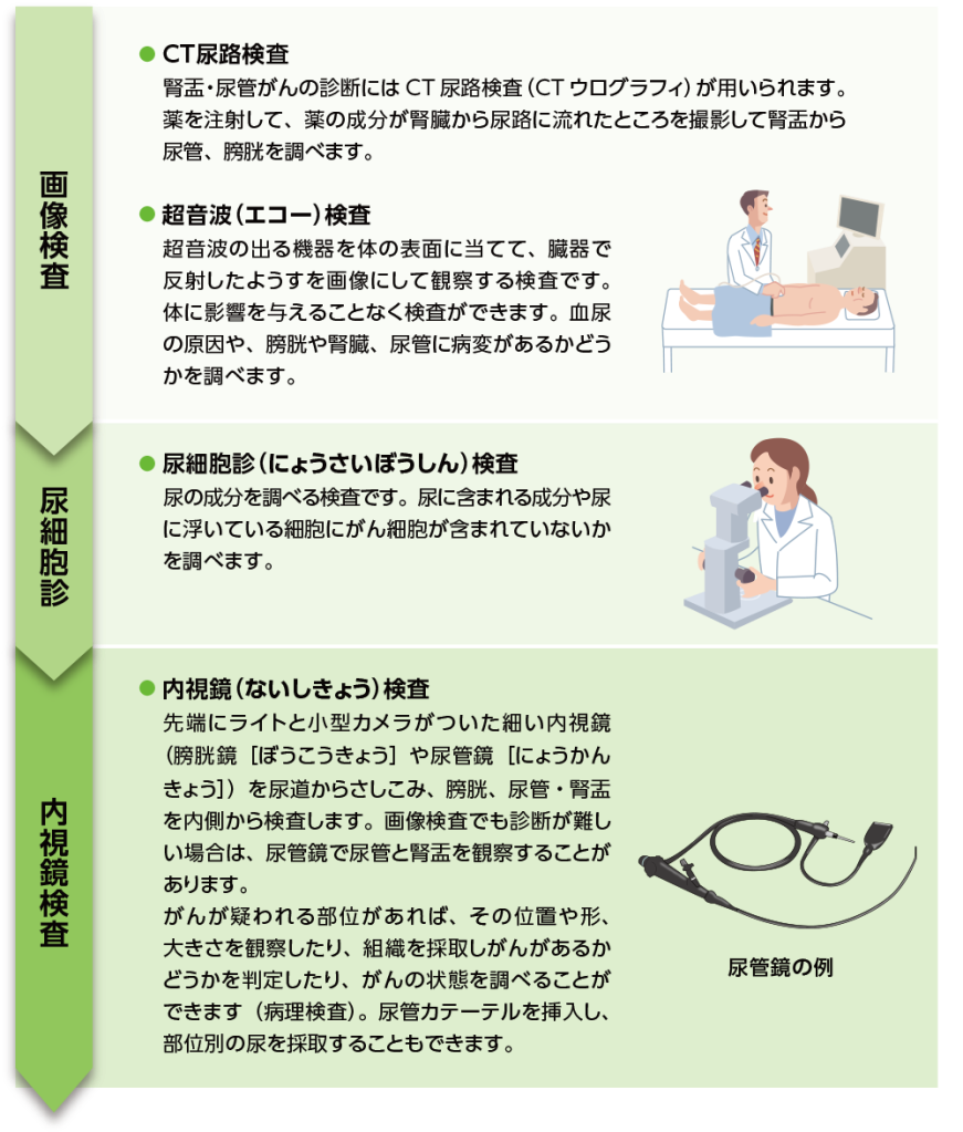 腎盂・尿管がんの確定診断までの流れ