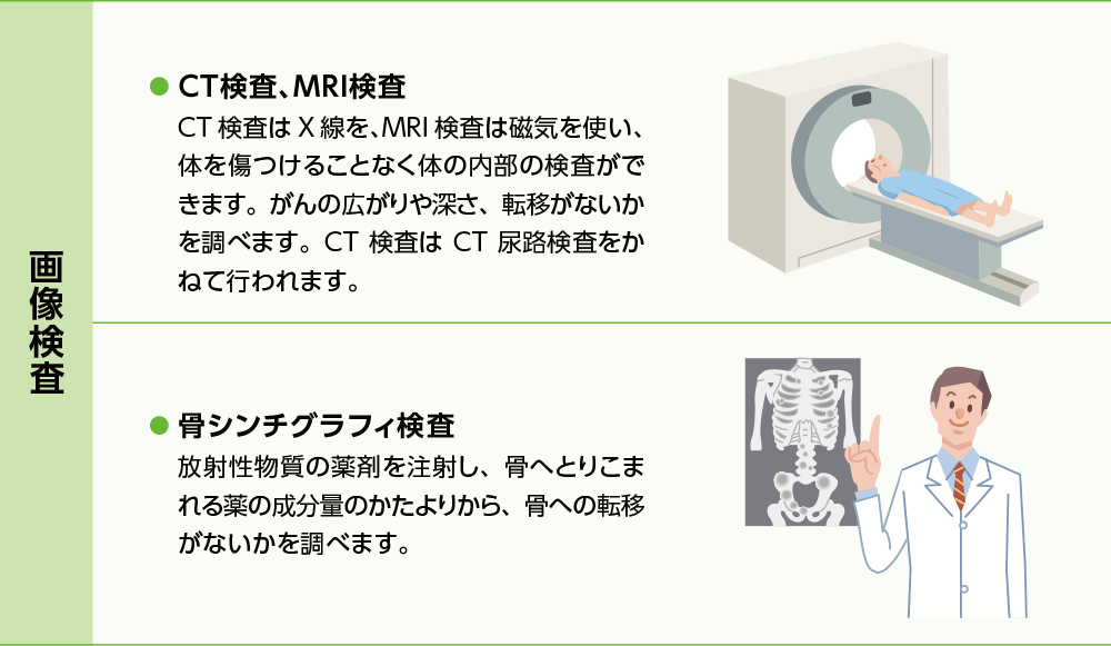 治療方針を決めるための検査